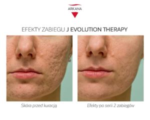 Reti Fusion Vecti Therapy - Arkana EN